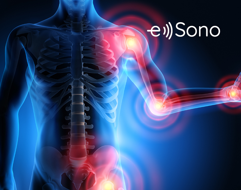 New: MSK Musculoskeletal course from e Sono!