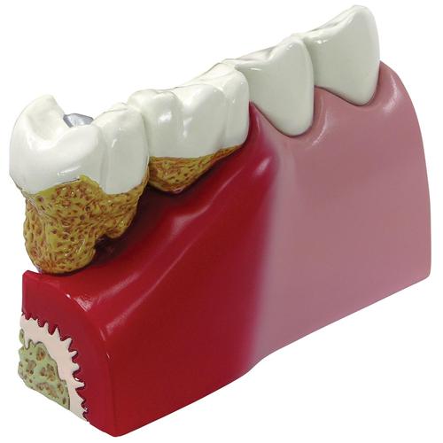 Модель зубов, 1019539, Модели зубов