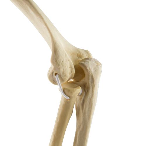 ORTHObones Стандартный Локтевые эластичные полосы, правые, 1019616, 3B ORTHObones Standard