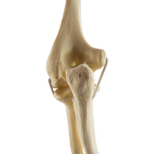 ORTHObones Стандартный Локтевые эластичные полосы, правые, 1019616, 3B ORTHObones Standard