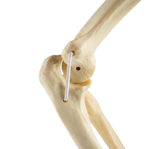 ORTHObones Стандартный Локтевые эластичные полосы, правые, 1019616, 3B ORTHObones Standard