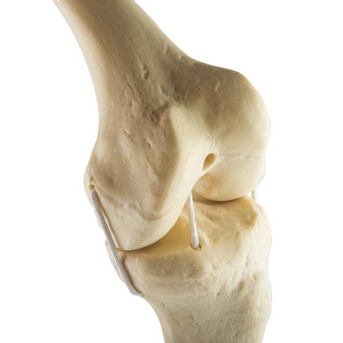 ORTHObones Стандартный Левое колено, 1019621, 3B ORTHObones Standard