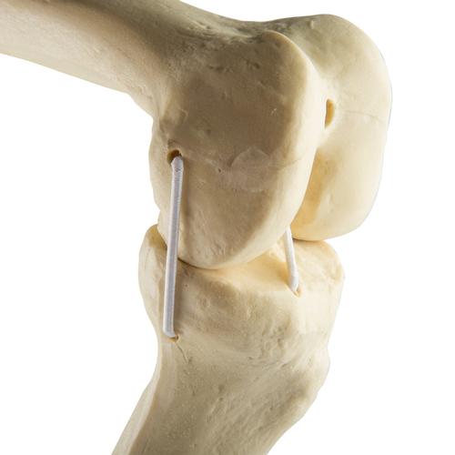 ORTHObones Стандартный Левое колено, 1019621, 3B ORTHObones Standard