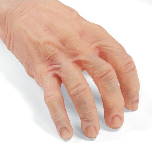 TERi™ Geriatric Patient Care Trainer - Androgynous trainer for general patient care & daily living assistance simulation, light skin, 1022931, Edema Diagnosis