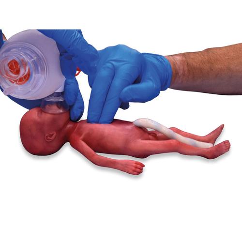 초미숙아 / 극저체중아(ELBW)  Micro-preemie Baby / Extremely Low Birth Weight Baby (ELBW)
, 1024668, Newborn