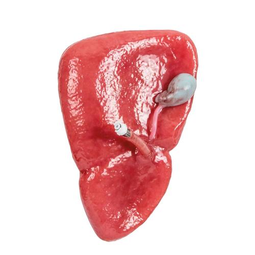 Liver w/ Gallbladder - Damaged, 1025972, TCCC Simulators