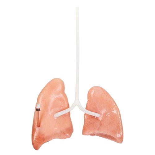 Lungs Damaged, 1025974, Surgery