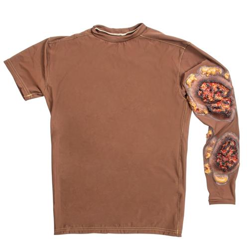 Full Thickness Arm Burn - Long Sleeve Shirt - Dark Skin, 1025983, TCCC Simulators