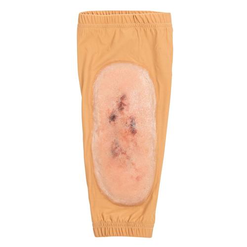 Tib/Fib Closed Fracture Sleeve - Medium Skin, 1025988, TCCC Simulators