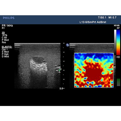Blue Phantom Elastography Ultrasound Breast Phantom, 3012468, Ultrasound Skill Trainers