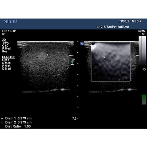 Blue Phantom Elastography Ultrasound Breast Phantom, 3012468, Ultrasound Skill Trainers
