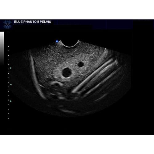 Blue Phantom Intrauterine Pregnancy Transvaginal Ultrasound Training ...