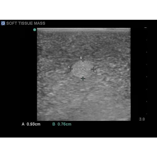 Blue Phantom Soft Tissue Biopsy Ultrasound Training Block Model, 3012511, Ultrasound Skill Trainers