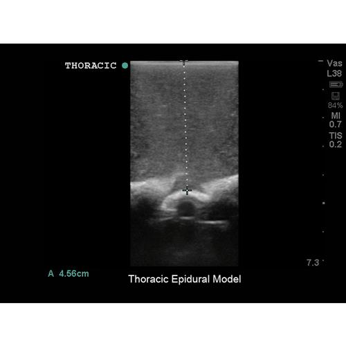 Blue Phantom Spinal Epidural, Lumbar Puncture and Thoracic Epidural Training Model, 3012515, Ultrasound Skill Trainers