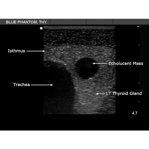 Blue Phantom Thyroid Biopsy Ultrasound Training Model, 3012518, Ultrasound Skill Trainers