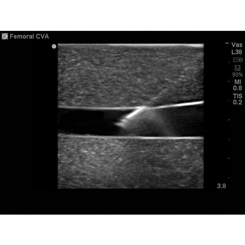 Blue Phantom True Anatomy Series Vascular Leg Model, 3012527, Ultrasound Skill Trainers