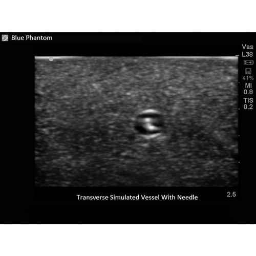 Blue Phantom True Anatomy Series Vascular Leg Model, 3012527, Ultrasound Skill Trainers