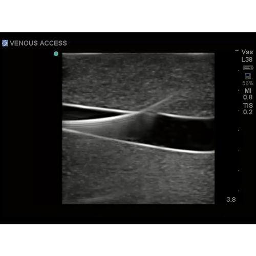 Blue Phantom Femoral Vessels and Nerve Replacement Tissue for BPP-025 to BPP-036, 3012555, Ultrasound Skill Trainers