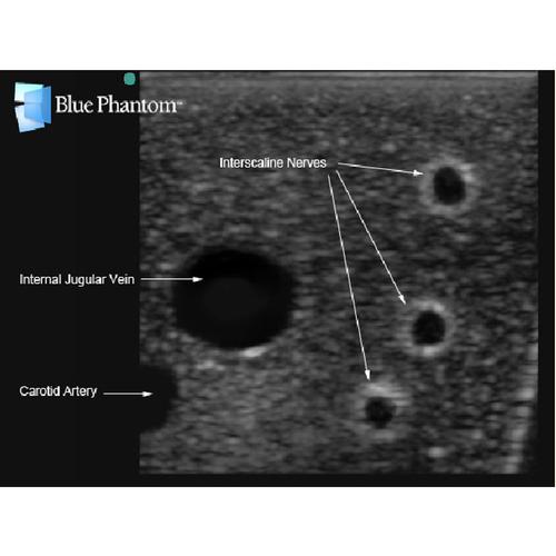 Blue Phantom Gen II Brachial Plexus Block and Ultrasound Central Line Replacement Tissue Insert, 3012567, Ultrasound Skill Trainers