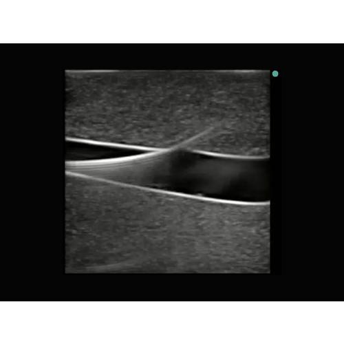 Blue Phantom Leg Tissue Insert with Saphenofemoral Vessels with DVT used with Model BPP-067, 3012578, Ultrasound Skill Trainers