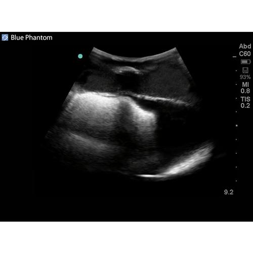 Blue Phantom Midscapular Thoracentesis Ultrasound Replacement Tissue, 3012581, Ultrasound Skill Trainers