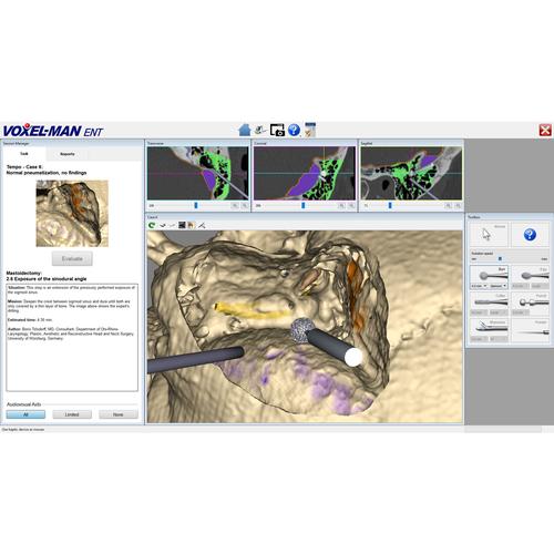 Tempo Software Module, 8001065, Ear, Nose and Throat Examination