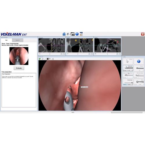 Módulo de Software Voxel-Man Sinus, 8001068, Exame Otorrinolaringológico