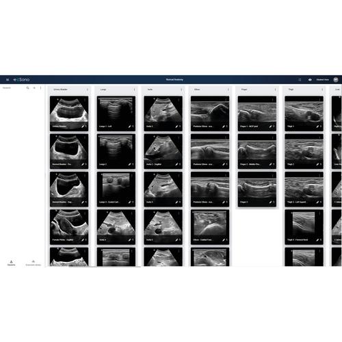Simulatore di ecografia e Sono - Licenza quadriennale, 300 utenti, 8001217, Ultrasound Simulation Software
