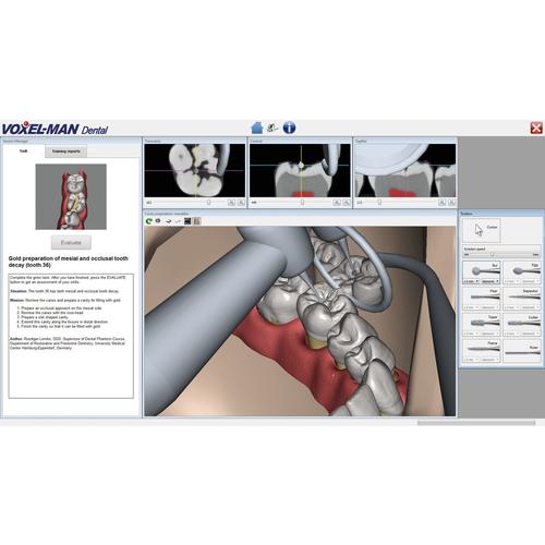 Dental Application Module, 8001246, Simulateurs de réalité virtuelle