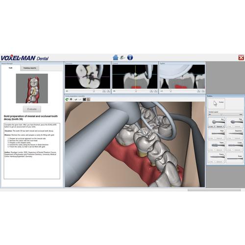 VOXEL-MAN Dental Application Module, 8001246, Virtual Reality Simulators