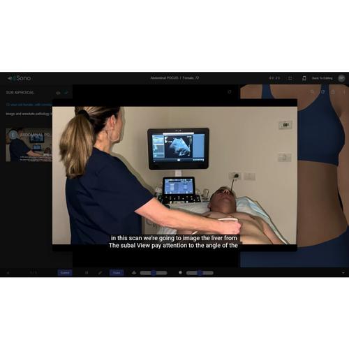 Abdominal POCUS e Sono 
1 User 3 Months, 8001269, Software de Simulación de Ultrasonido