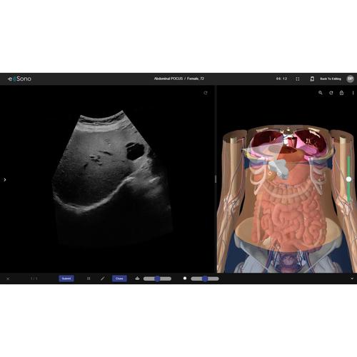 Abdominal POCUS e Sono 1 Benutzer 3 Monate, 8001269, e Sono Kurse
