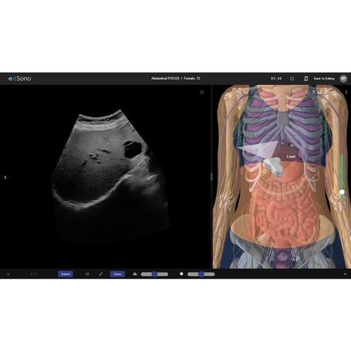 Abdominal POCUS e Sono 1 Benutzer 3 Monate, 8001269, e Sono Kurse
