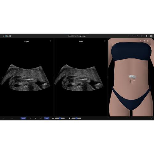 Curso Básico de Ultrasonido Ginecológico y Obstétrico (OB/GYN) de e Sono
Para usuarios finales, 8001270, Cursos e Sono