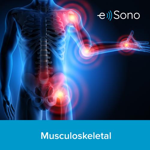 e Sono Cours POCUS Musculosquelettique (MSK) 1 utilisateur 3 mois, 8001272, Cours e Sono