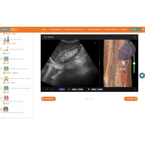 POCUS E-Sim Complete by GUSI & e Sono
1 utente 1 anno, 8001276, POCUS E-SIM Complete