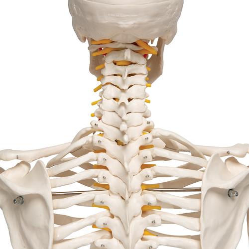 Menschliches Skelett Modell "Fred", lebensgroß mit flexibler einstellbarer Wirbelsäule mit Nerven, Arterien & Bandscheibenvorfall, auf Metallstativ mit Rollen, 1020178 [A15], Skelette lebensgroß
