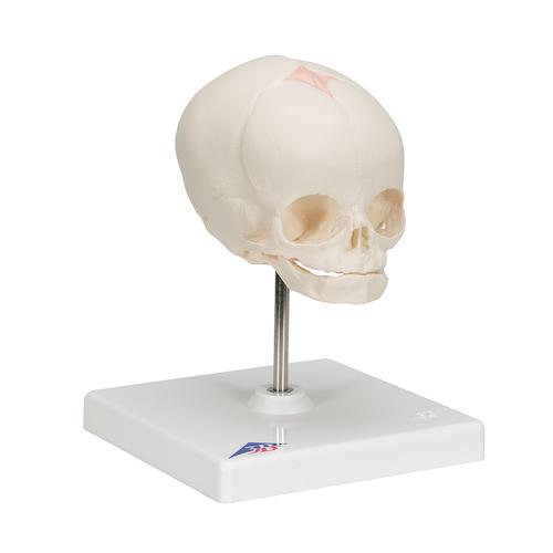 임신 30주째 태아 두개골(머리뼈)모형, 받침대포함  Foetal Skull Model, natural cast, 30th week of pregnancy, on stand, 1000058 [A26], 두개골 모형