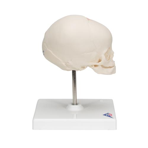 임신 30주째 태아 두개골(머리뼈)모형, 받침대포함  Foetal Skull Model, natural cast, 30th week of pregnancy, on stand, 1000058 [A26], 두개골 모형