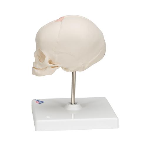 임신 30주째 태아 두개골(머리뼈)모형, 받침대포함  Foetal Skull Model, natural cast, 30th week of pregnancy, on stand, 1000058 [A26], 두개골 모형