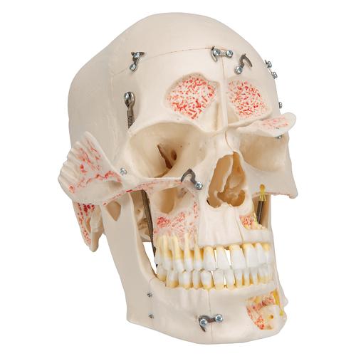 Deluxe Human Demonstration Dental Skull Model, 10 part, 1000059 [A27], Human Skull Models