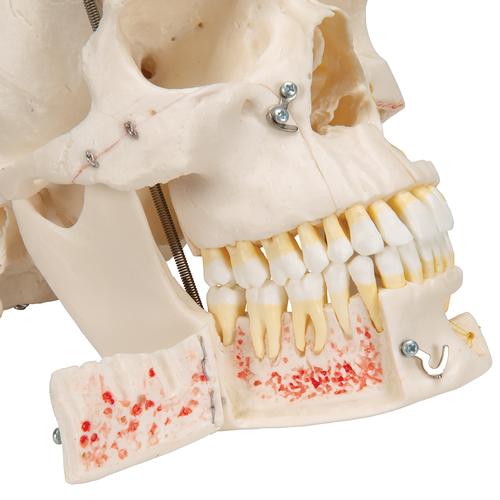 Deluxe Human Demonstration Dental Skull Model, 10 part, 1000059 [A27], Human Skull Models