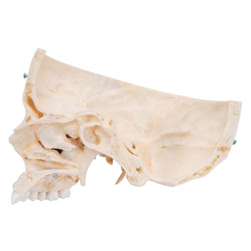 실제 뼈와 유사한 조직으로 제작한 두개골 모형, 6 파트 BONElike Human Bony Skull Model, 6 part, 1000062 [A281], 두개골 모형