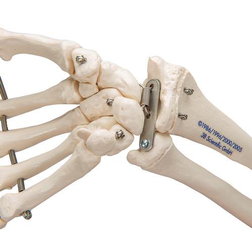 Esqueleto de la mano con porciones de ulna y radio articulado, 1019370 [A41], Modelos de esqueleto de brazo y mano