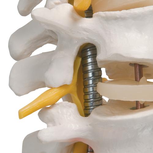 Highly Flexible Human Spine Model, Mounted on a Flexible Core, 1000130 [A59/1], Human Spine Models