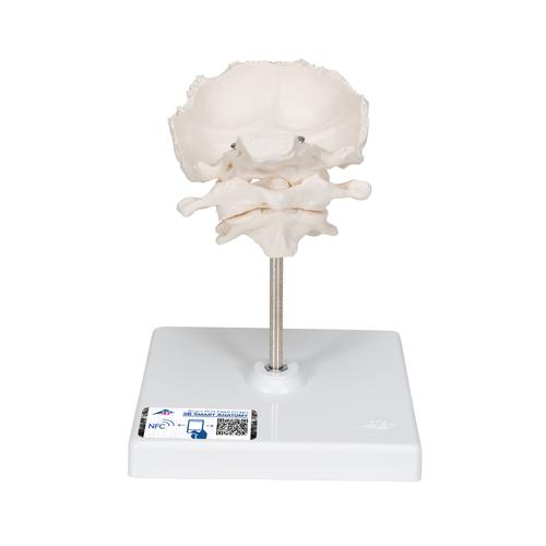 Atlas & Axis Model with Occipital Plate, Wire Mounted, on Removable Stand, 1000142 [A71/5], Vertebra Models