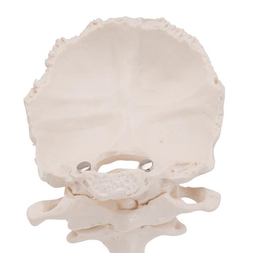 Atlas & Axis Model with Occipital Plate, Wire Mounted, on Removable Stand, 1000142 [A71/5], Vertebra Models