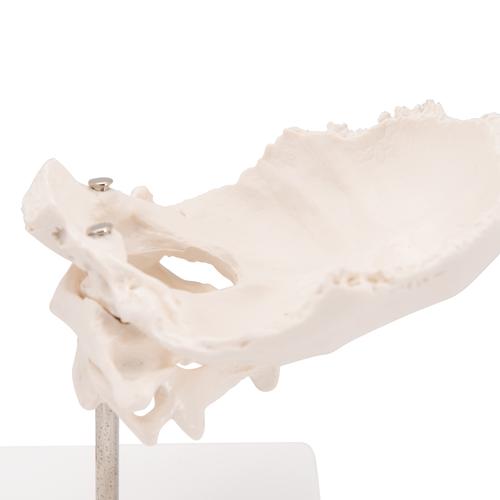 Atlas & Axis Model with Occipital Plate, Wire Mounted, on Removable Stand, 1000142 [A71/5], Individual Bone Models