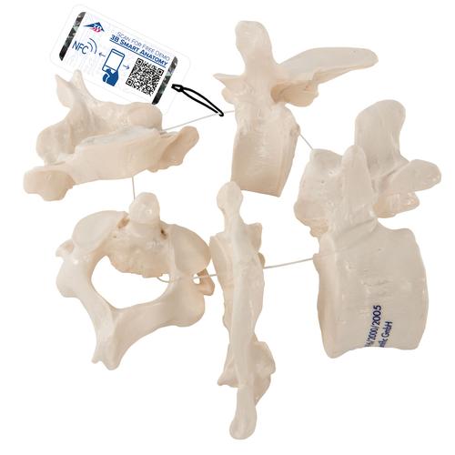 5 Human Vertebrae, Loosely Threaded on Nylon (atlas, axis, cervical, thoracic, lumbar), 1000148 [A75/1], Vertebra Models