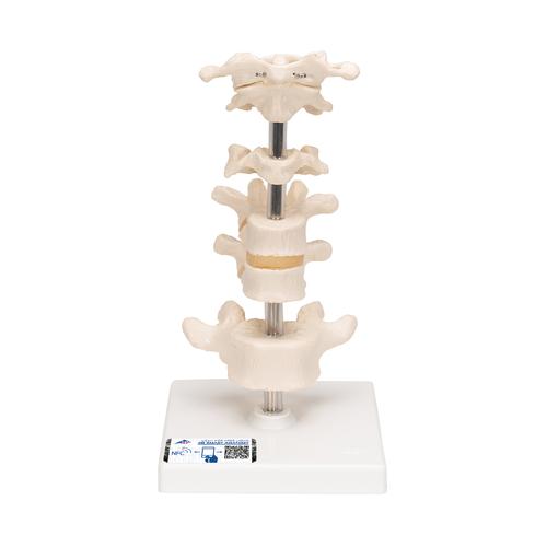 6 분리 척추 모형 Model of 6 Human Vertebrae, Mounted on Stand (atlas, axis, cervical, 2x thoracic, lumbar), 1000147 [A75], 척추뼈 모형